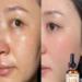 Discover the Best Hydrating Facial Oil for Sensitive Skin and Lasting Glow Discover the Best Hydrating Facial Oil for Sensitive Skin and Lasting Glow