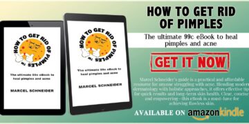🌟 Ready to say goodbye to those pesky pimples once and for all? Your clear skin journey starts here! 💫